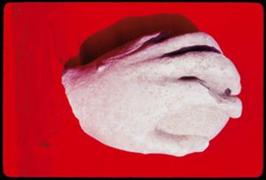PR308_07_11
